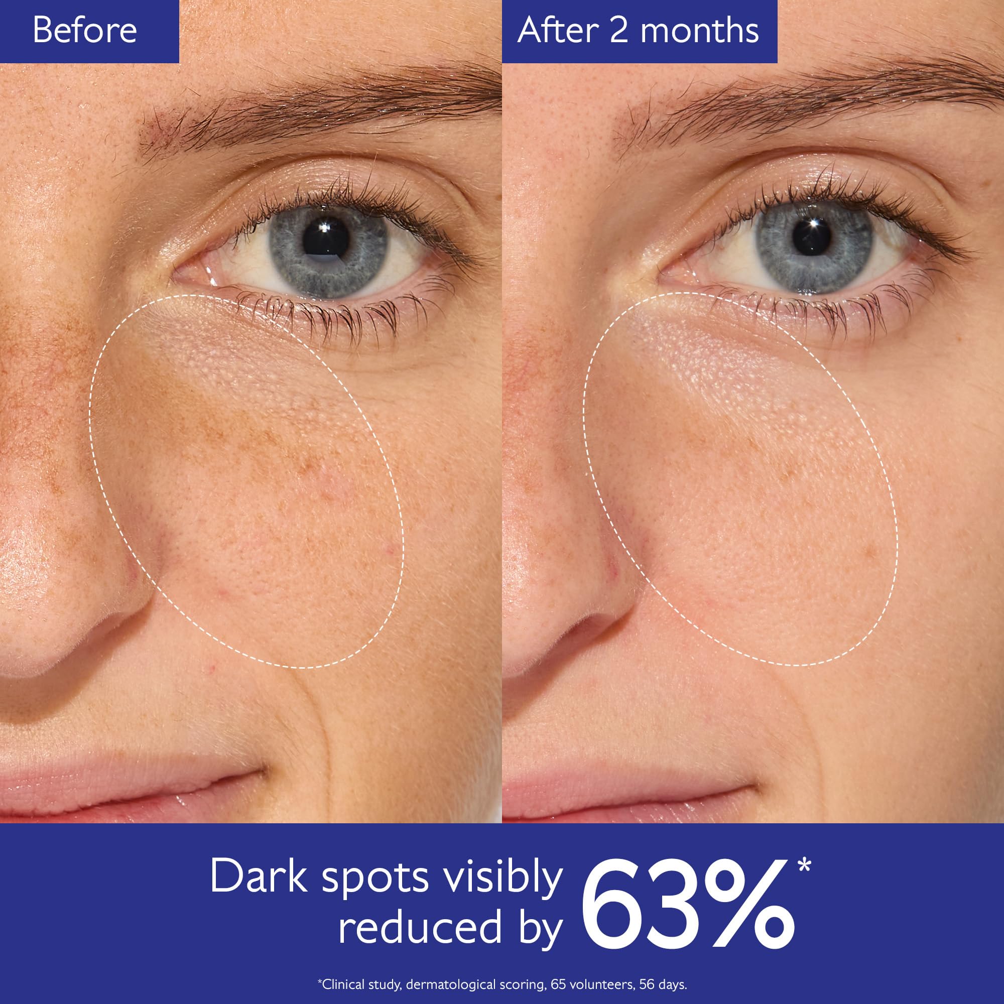 Caudalie Vinoperfect Radiance Serum with Natural Viniferine – Brightening Face Serum, 50 mL